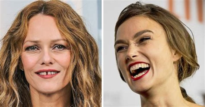 Celebrities Who Embrace Their Perfectly Imperfect Smiles