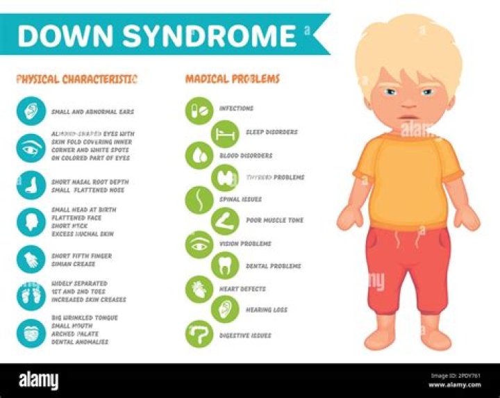Simon Cowell's Son Inspiring Others With Down Syndrome