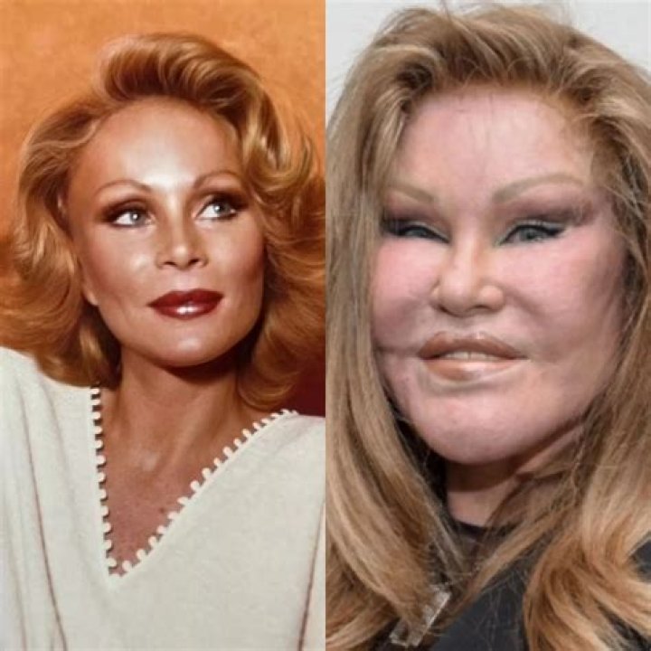 The Enigmatic Transformation Of Jocelyn Wildenstein: A Journey Of Excess And Controversy