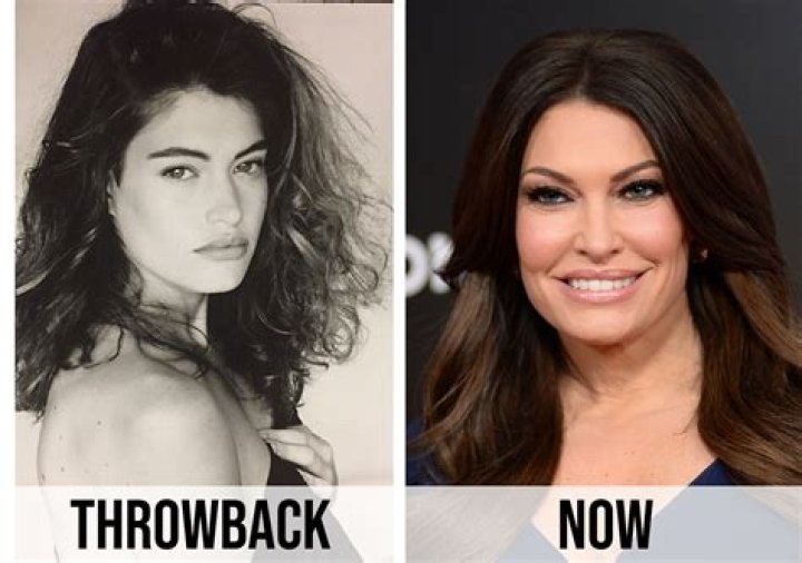 Transformative Journey: Kimberly Ann Guilfoyle Before And After