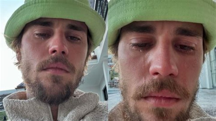 Unraveling The Mystery: Why Justin Bieber Looks Sick
