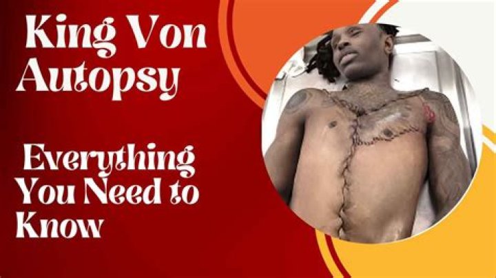 Unveiling The Mystery: The King Von Autopsy Pics And Their Impact