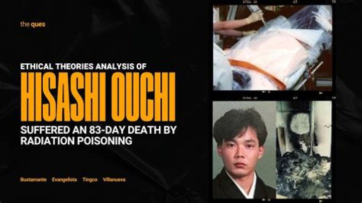 Unveiling The Mystique Of Ouchi Radiation Pictures: A Journey Through Time