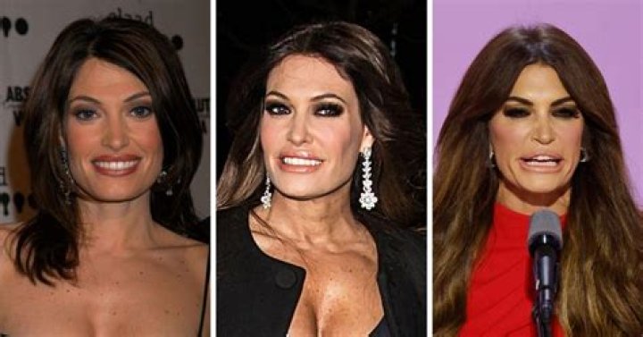 Unveiling The Secrets Behind Kimberly Guilfoyle's Face Transformation