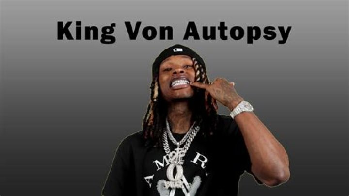 Unveiling The Truth: King Von Autopsy Photos And Their Implications